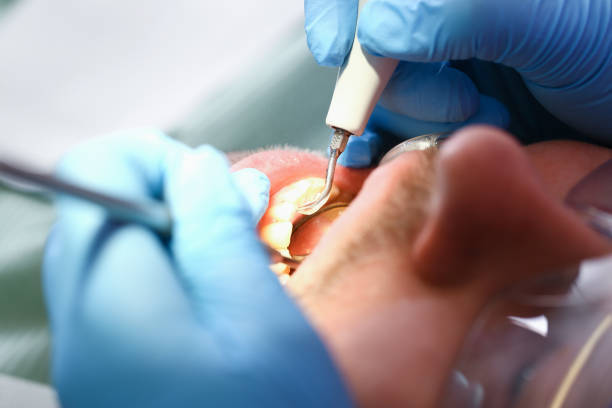 Best Knocked-Out Tooth Emergency  in Mogul, NV