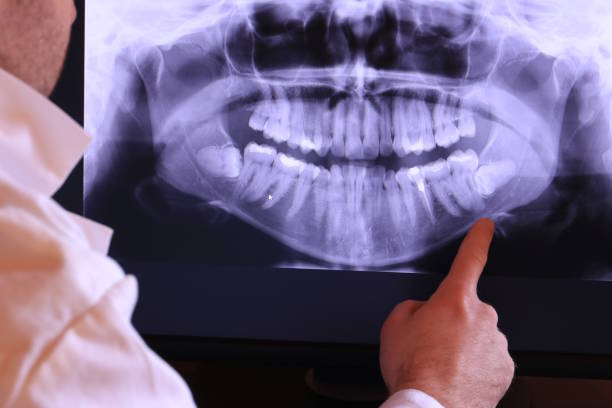 Best Urgent Tooth Repair  in Mogul, NV